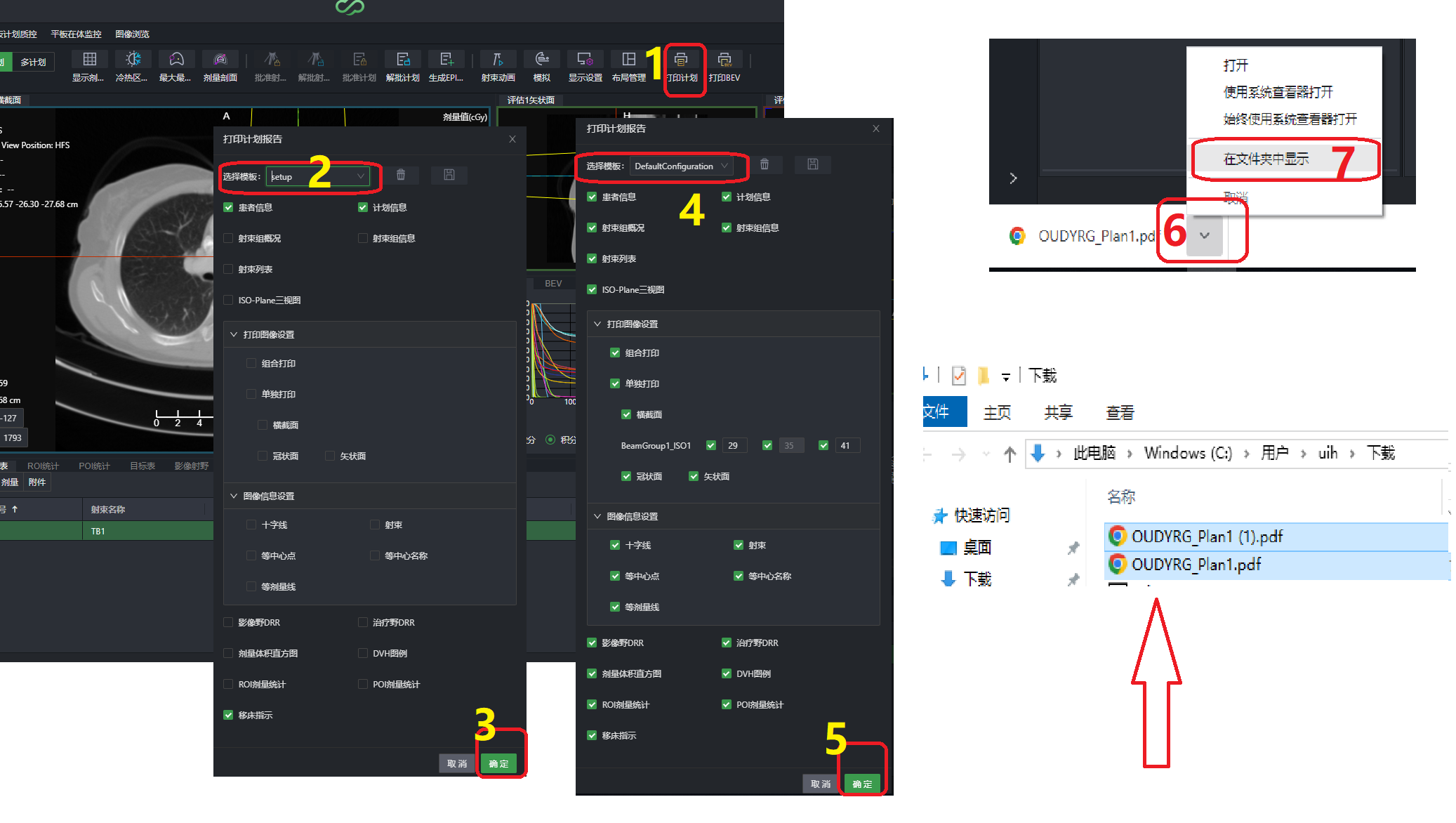 打印报告